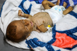 Sick children in Gaza are "desperately" waiting for treatment abroad.